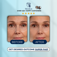 Silicone Anti-Wrinkle Patch Kit, Large (Stretch Marks) and Small (Face)