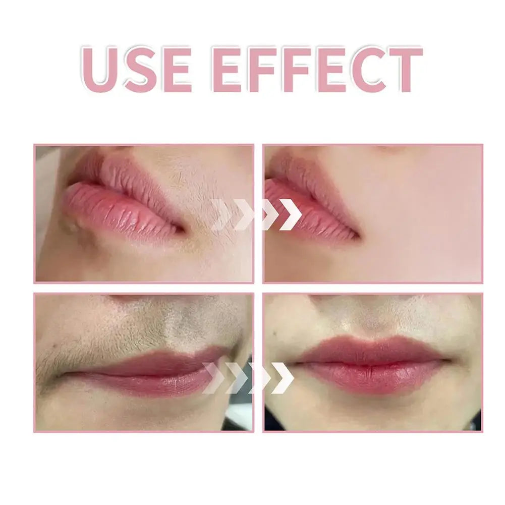 Facial Hair Remover [Hair Identifier Spray] + Dermaplanar